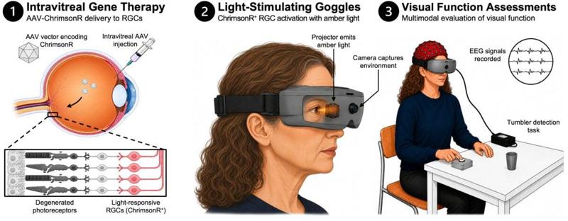 None Illustrazione in tre pannelli che mostra un’iniezione nell’occhio, occhiali che stimolano la vista con la luce e un partecipante sottoposto a test visivi con registrazione EEG.