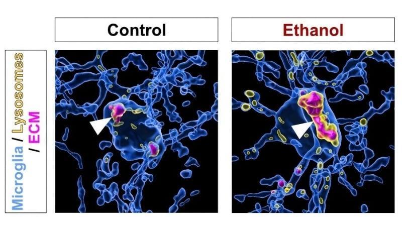None L’alcol induce le cellule immunitarie a distruggere la matrice strutturale del cervello, secondo uno studio sui topi