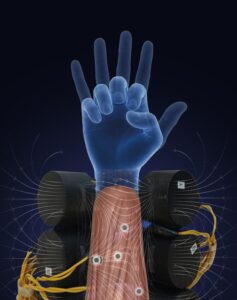 La mano robotica che percepisce i movimenti
