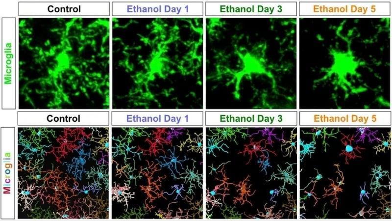 None L’alcol induce le cellule immunitarie a distruggere la matrice strutturale del cervello, secondo uno studio sui topi