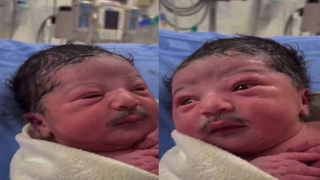 Neonato nasce con baffi folti e scuri: le immagini fanno il giro del web
