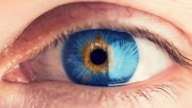 Vista parzialmente ripristinata in alcuni pazienti ciechi grazie a un nuovo trattamento sperimentale